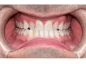 Zuby po 8 měsících (v2)